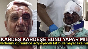 Ağabey-kardeş arasındaki miras kavgası kanlı bitti: 5 yaralı