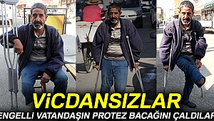 Engelli vatandaşın protez bacağını çaldılar