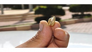 MAGANDANIN SİLAHINDAN ÇIKAN YORGUN MERMİ YARALADI 