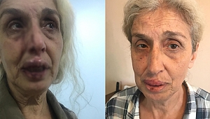 SOKAK HAYVANLARINI BESLERKEN BAŞKA KADINLARIN SALDIRISINA UĞRADI