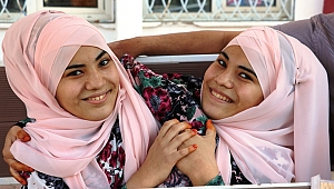 SİYAM İKİZLERİNİN ÜNİVERSİTE HAYALİ GERÇEK OLUYOR