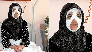Bomba Gibi Patlayan Düdüklü Tencere Genç Kadına Dehşeti Yaşattı