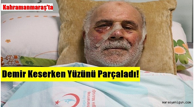 Kahramanmaraş’ta Demir Keserken Yüzünü Parçaladı!