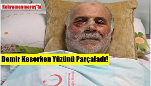 Kahramanmaraş’ta Demir Keserken Yüzünü Parçaladı!