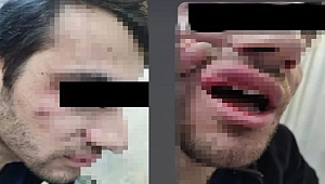 Kahramanmaraş’ta Doktor Erkek Hemşireyi Darp Etti İddiası