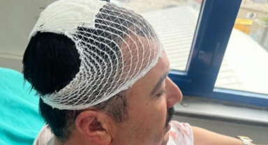 Yeniden Refah Partili Başkan Yardımcısı, Belediye Başkan Yardımcısının Kafasına Şekerlikle Vurdu