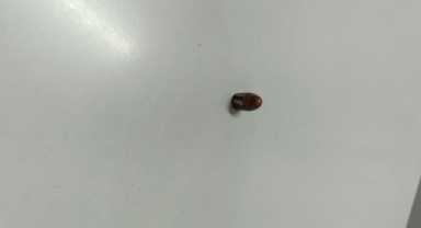 Yorgun Mermi İş Yerine İsabet Etti